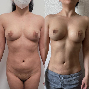 Slider image (2) Dr. Gabriel Sandoval - Plastic Surgeon in Mexico